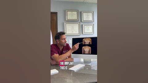 What a capsular contracture looks like #breastexplant #explantsurgery #plasticsurgeon