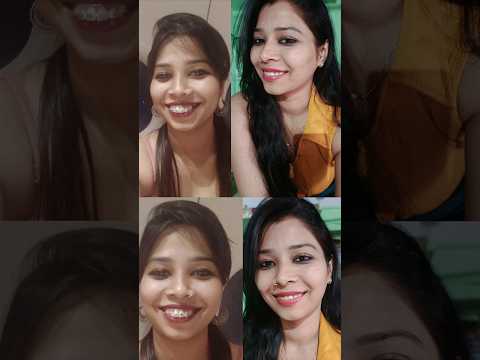 My complete braces