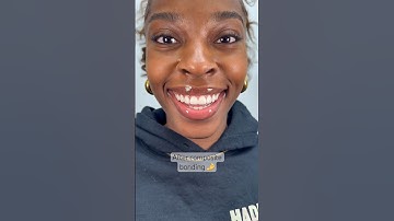 Composite bonding by Dr. Josh 🤌 #newsmile #veneers #compositebonding #viral