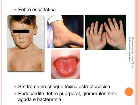 Vídeo: Gram positivo ou negativo é mais perigoso?