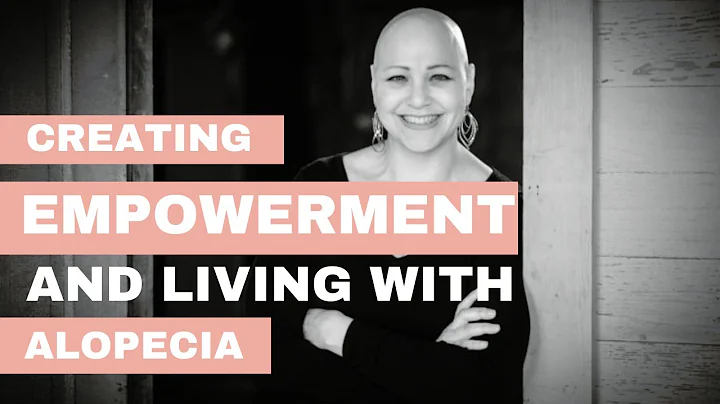 #32 Empowered Living & Alopecia with Deeann Graham