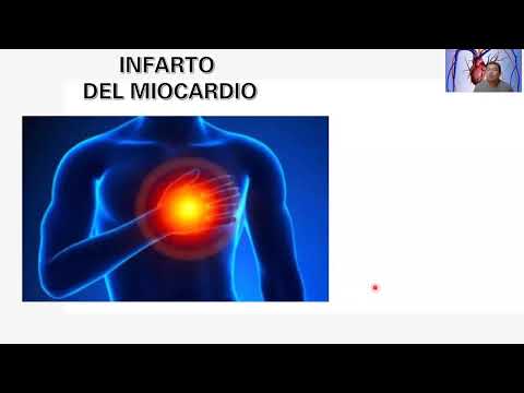 CARDIOTIPS HIPERTENSION ASESINO SILENCIOSO