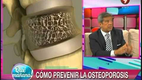 ¿Se puede evitar que la osteoporosis empeore?