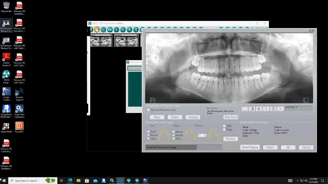 Panoura 18S Dental Panoramic X-ray Machine Capturing with Dexis