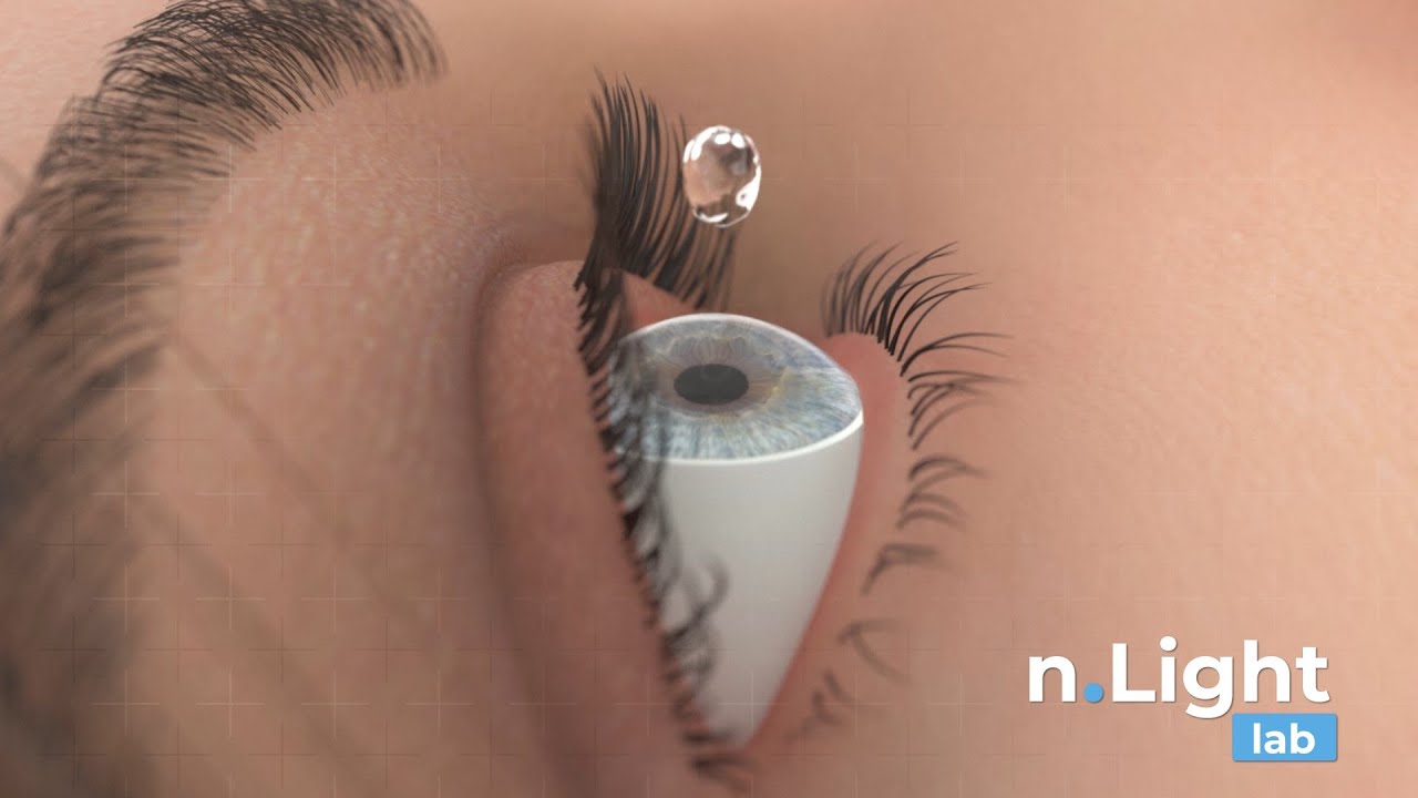 nLight Medical 3D Demoreel  2023