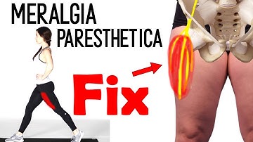 Meralgia paresthetica - upper leg pain - upper thigh pain