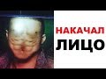 Лютые приколы. Накачал лицо. Соски вместо глаз!!!