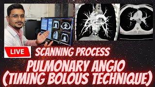 Pulmonary Angiography (timing bolous technique) | live scanning process of pulmonary angio screenshot 4