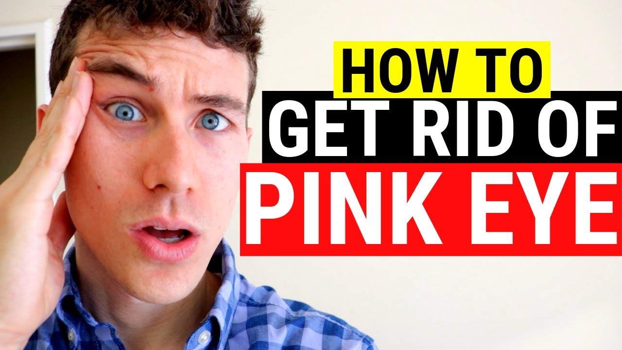 🔴 How To Get Rid Of Pink Eye | 3 Must Know Facts About Pink Eye And Conjunctivitis