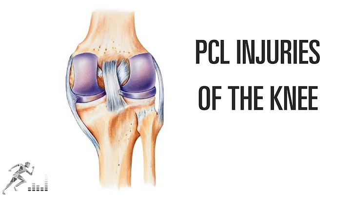 PCL injury of the knee: Mechanism of injury and treatment options