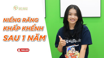 Sau 1 năm niềng răng khấp khểnh thay đổi ra sao? - KH P.T Mỹ Lộc