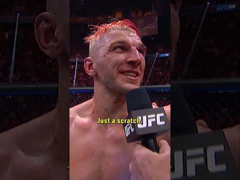 it's just a scratch 🤣 #ufcparis