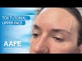 Tox tutorial upper face