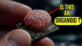 Scientists Built a Computer Out of Living Human Brain Cells