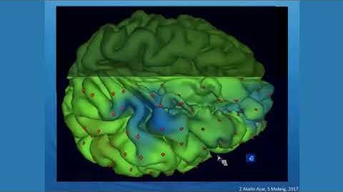 Modeling Distributed Brain Dynamics from Neuroelectromagnetic Data | Dr.  Scott Makeig