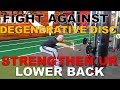 Strengthen Your Lower Back with Degenerative Disc Disease