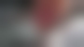 Locking compression plate LCP