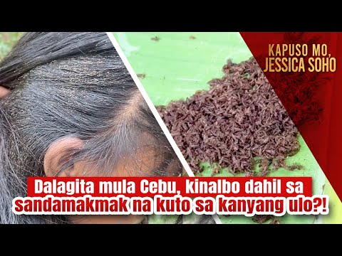 Image of Dalagita mula Cebu, kinalbo dahil sa sandamakmak na kuto sa kanyang ulo?! | Kapuso Mo, Jessica Soho