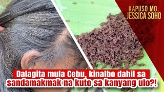 Dalagita mula Cebu, kinalbo dahil sa sandamakmak na kuto sa kanyang ulo?! | Kapuso Mo, Jessica Soho image
