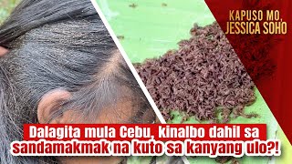 Dalagita mula Cebu, kinalbo dahil sa sandamakmak na kuto sa kanyang ulo?! | Kapuso Mo, Jessica Soho