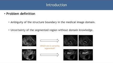 Structure Boundary Preserving Segmentation for Medical Image With Ambiguous Boundary
