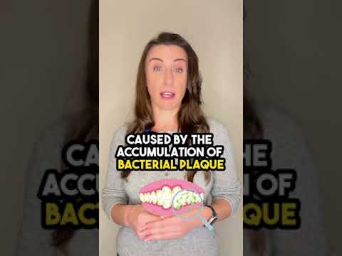How to You Know if You Have Gingivitis?