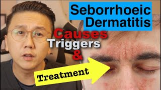 Seborrhoeic Dermatitis - Causes, Triggers & Treatment Options