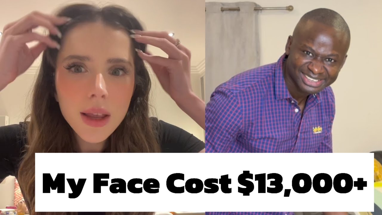 My Face Cost $13,000+