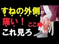 すねの外側が痛い(原因と分類編)