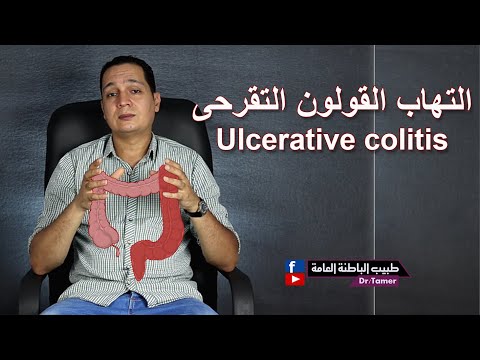 فيديو: أين هو التهاب اللفائفي العكسي؟