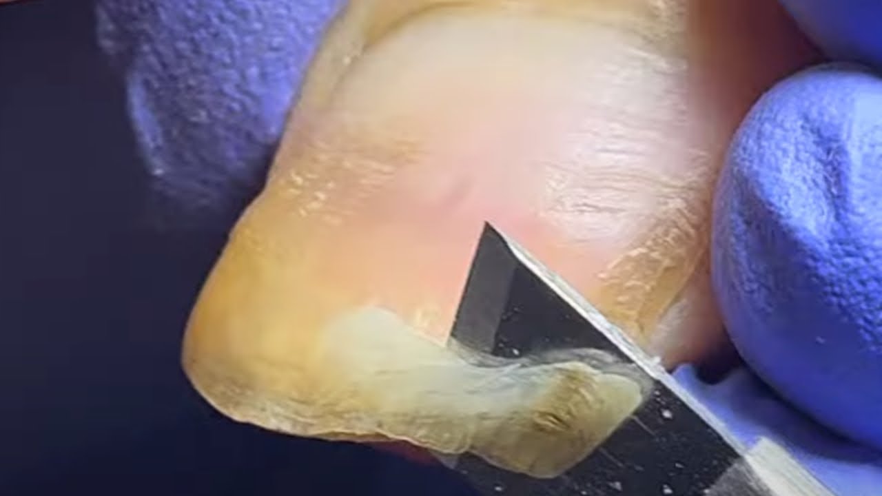 Cut Extra Long Nails Easily【 Pedicure King】 - YouTube