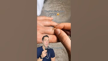 Try this dehydration test!