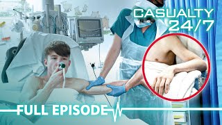 Doctors Reset Dislocated Arm | Casualty 24/7 - S04 E10 (Full Episode)