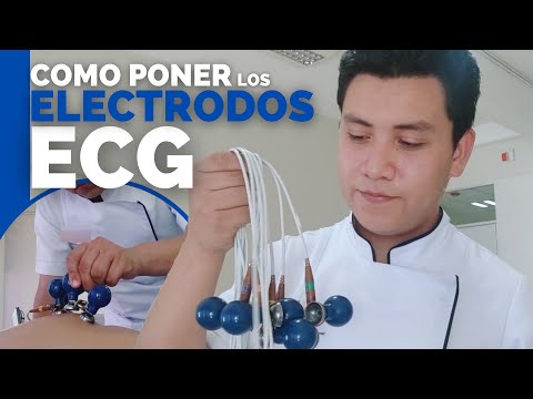 Video: ¿Dónde se realiza el electroencefalograma en Calcuta?