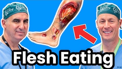 Flesh Eating Disease - Necrotizing Fasciitis- Infectious Disease Doctor Explains