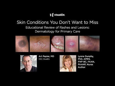 Video: Skin diseases alphabet: A, I, P, E