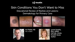 Skin Conditions You Don't Want to Miss screenshot 1