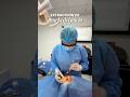 #muelasdeljuicio #shortvideo #shorts #viral #dentist #mueladeljuicio #subscribe #like