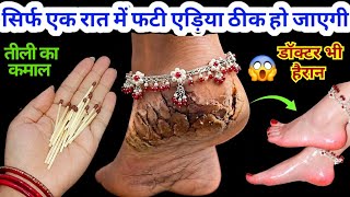 गारंटी है! 1 ही रात में ठीक हो जाएंगी फटी एड़ियांये जादुई उपाय एड़ी सॉफ्ट-मुलायम करेगा 😱Cracked Heels
