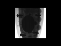 Capturing series of xray pictures with high resolution hamamatsu sensor