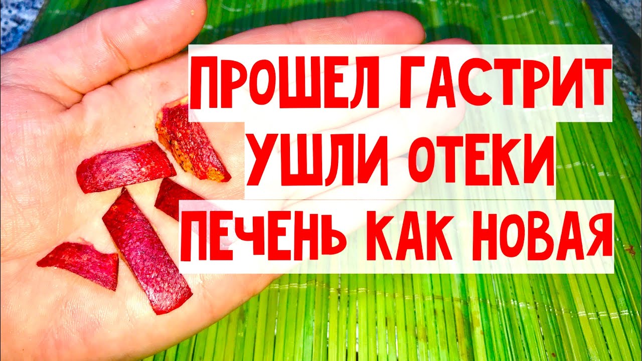 Камни в ПОЧКАХ растворились! ПРОШЁЛ гастрит, ушли ОТЁКИ и Печень ЧИСТАЯ ...