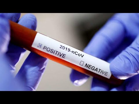 COVID 19 - ინფიცირების კლების ტენდენცია