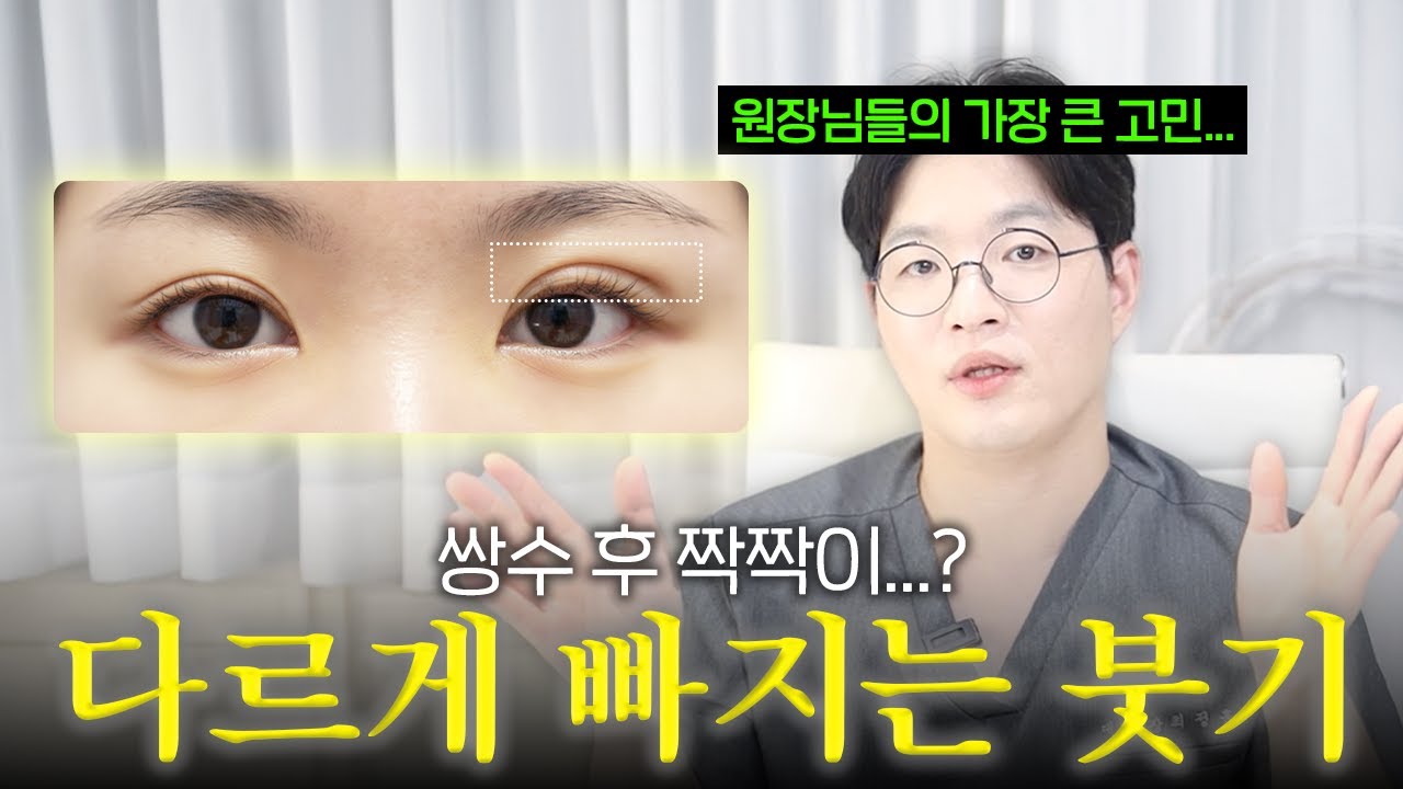쌍수를 했는데 눈 모양이 이상해요 영상 썸네일