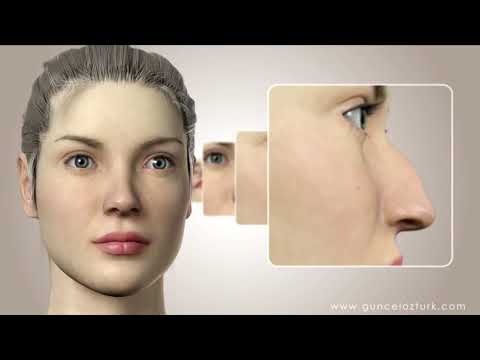 Видео: Как да сменя пръстена на носа?