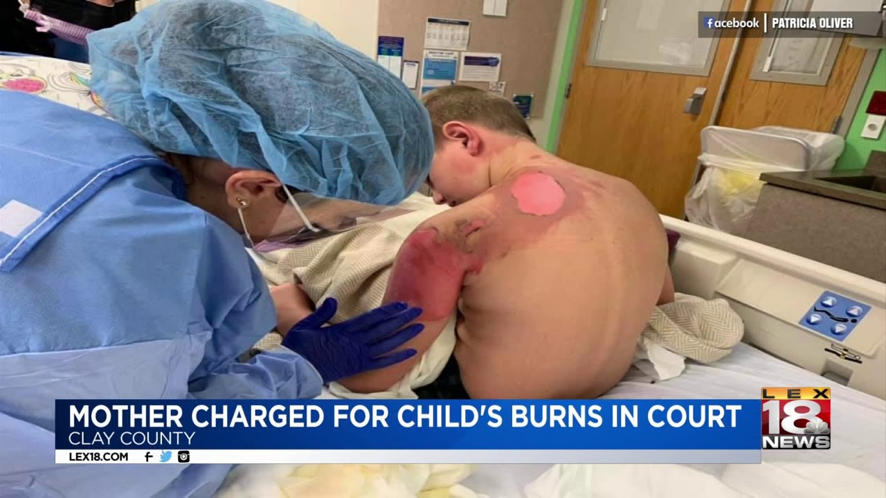 Mother Charged for Child's Burns in Court newspaper mockup