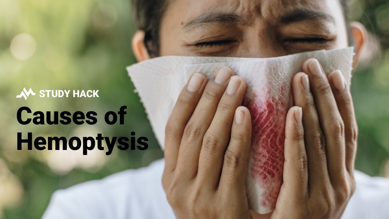 Causes of Hemoptysis (Coughing Blood) 