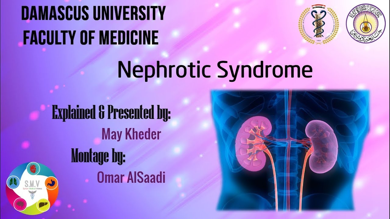 المتلازمة النفروزية Nephrotic Syndrome - جامعة دمشق - S.M.V
