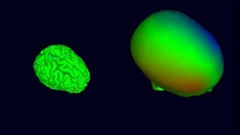 30 EEG Sources & Scalp Projections (1/5th speed)