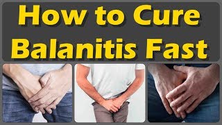 How To Cure Balanitis With Oils Fast And Causes, Symptoms, And Treatment Of Balanitis