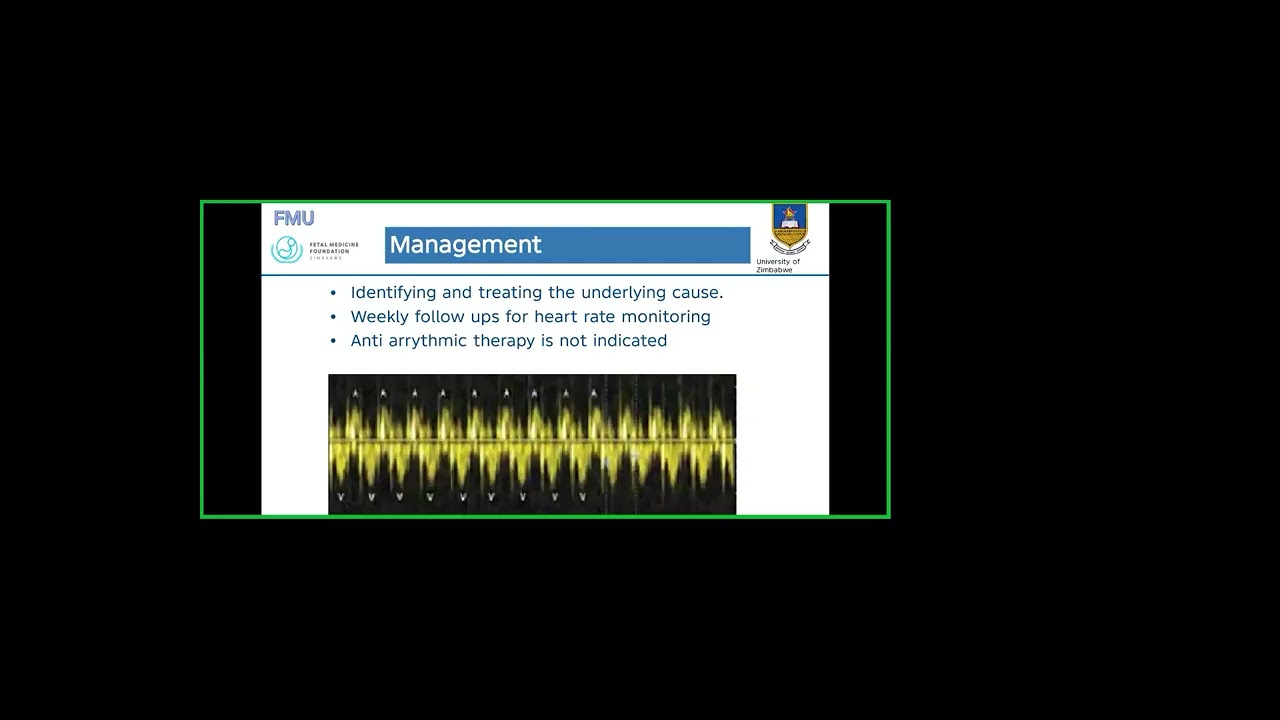 Fetal Tachyarrhythmia
